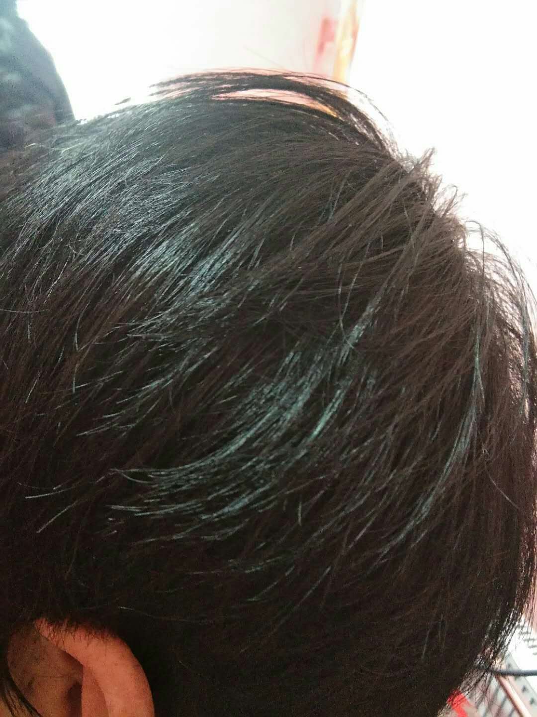 ��ҩֲ��Ⱦ������9.9Ԫ����