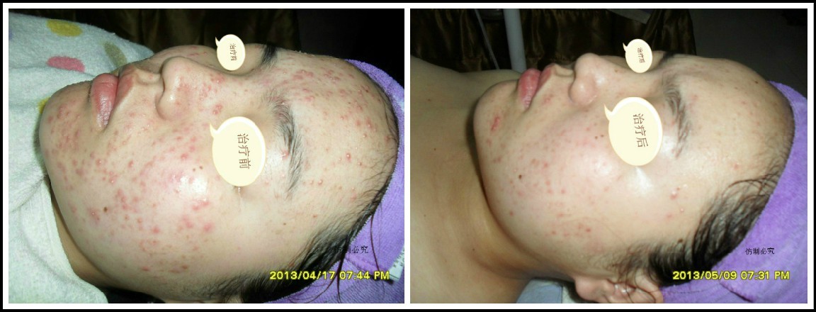 ��ɫ����������ҩ��Ĥ��Ѵ��ڼ���